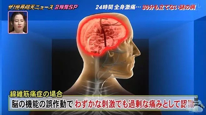 只因患这种怪病每天只能站立30分钟，一周要打40多支止痛针的日本妹子却逆袭成了一位模特！（组图） - 32