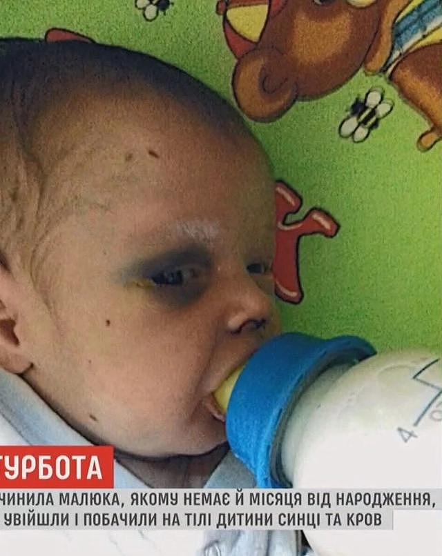 乌克兰一个月大的男婴被妈妈打得鼻青脸肿，妈妈打完却出去约会了
