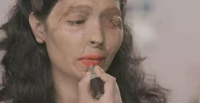 17岁被姐夫泼硫酸毁容，她却用一个妆感动了世界（组图） - 6