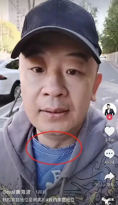 靠父亲养老金生活，秋衣穿到脱线？被封杀五年的黄海波彻底放弃做演员了（组图） - 8