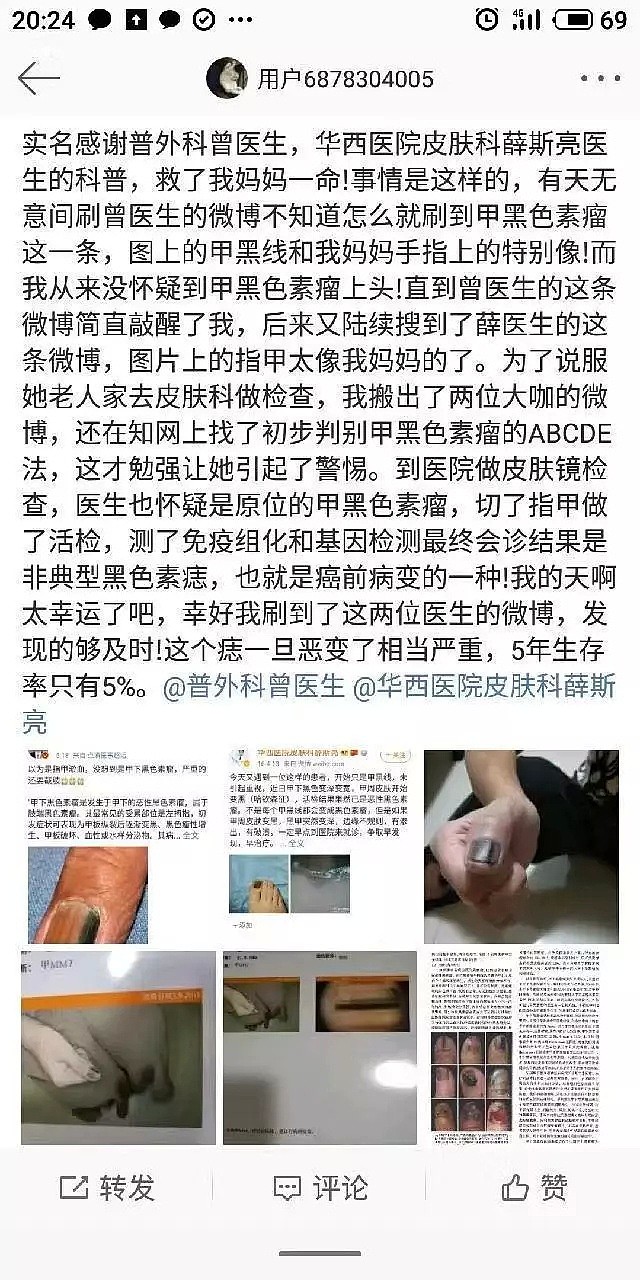 看了医生这条微博，她救了妈妈一命！指甲有这个表现，千万别掉以轻心！（组图） - 2