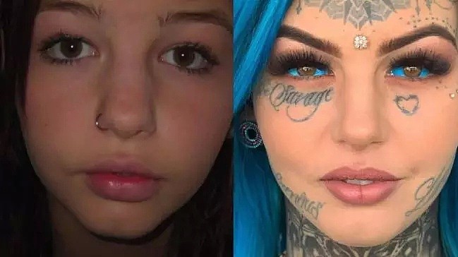 人间小龙女：澳洲女孩挑战“眼球纹身”，眼睛注射蓝墨水，称“像是玻璃碎片在揉我眼睛” - 8