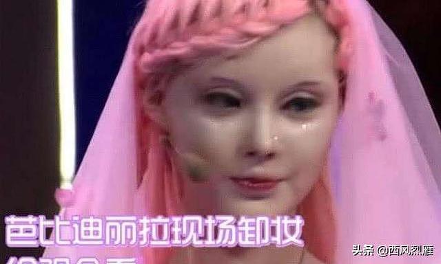 浙江女孩痴迷芭比娃娃，不惜在脸上割了108刀，后终成芭比女神