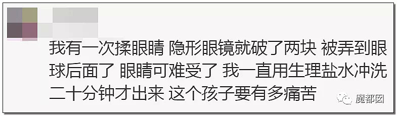 惨绝人寰！疼到嗷叫！小学女生被男同学强行在眼睛里塞纸片！母亲当场崩溃...（组图） - 26