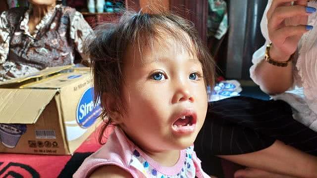  印尼小女孩患罕见病眼球天生能变4种颜色！医生：是遗传但无害（组图） - 1