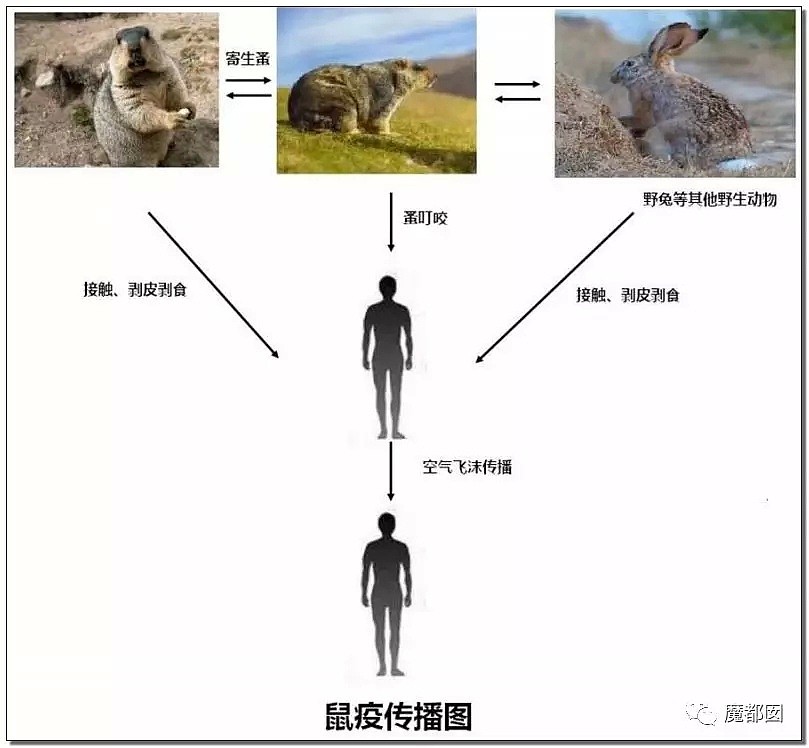 北京确诊两例鼠疫！过往那些恶心恐怖的病例和这些事实，必须要和大家说说了...（组图） - 47