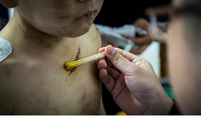 “心情不好就用电线打”陕西7岁男童遭亲妈家暴遍体鳞伤，涉事者被拘