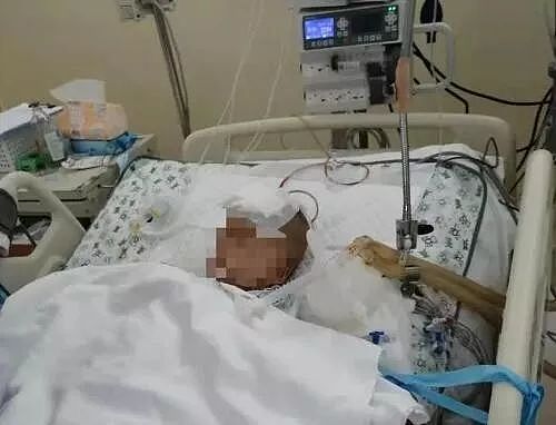 被高空坠物砸中的4岁男童仍在ICU！妈妈的举动让人泪目（组图） - 1