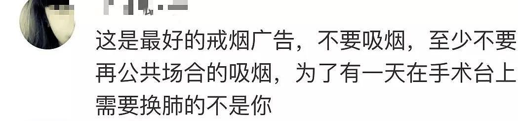 可怕！30年烟龄男子捐肺，医生取出后竟没人敢要！看完后我吓懵了...（视频/组图） - 6