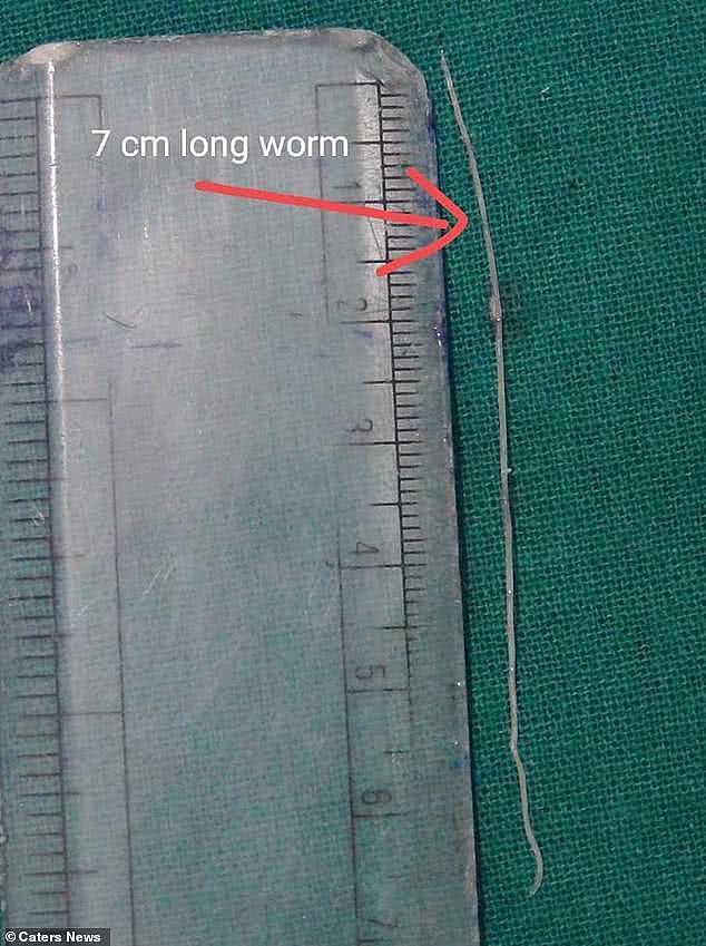 印度70岁老人眼睛里取出7厘米寄生虫，医生称可能和被狗咬有关