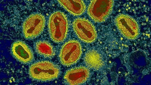 最新消息！澳大利亚科学家设计出新型病毒！对人体无害还可以杀死所有已知癌细胞！（组图） - 4