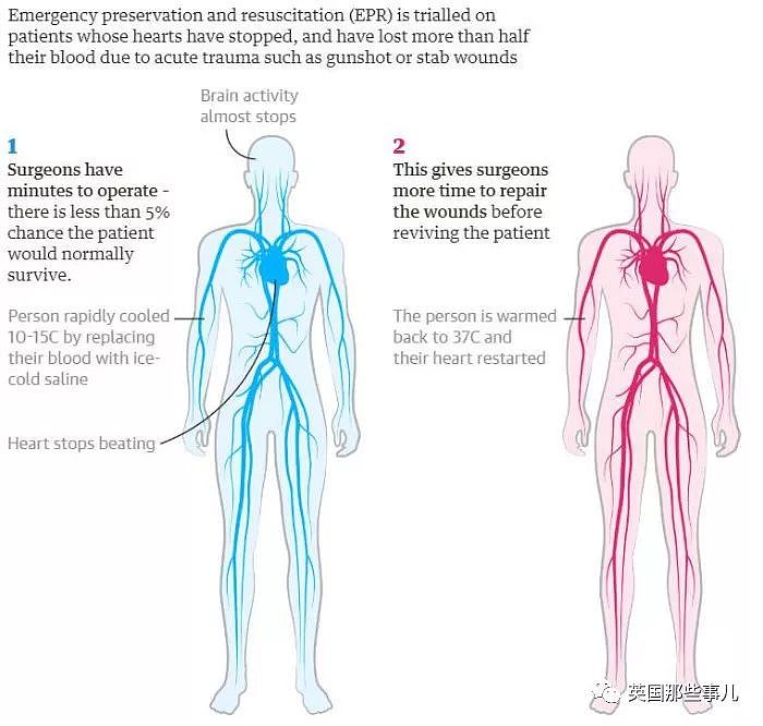 美国医生首次将人置于假死状态，有望让外伤患者先假死，再复苏！（组图） - 3