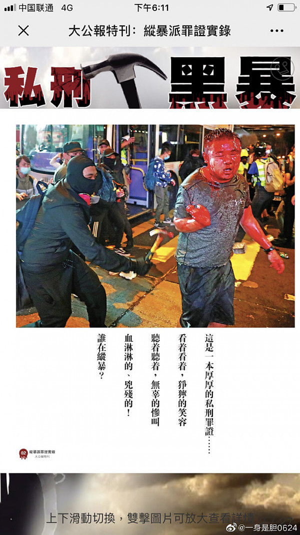 大陆游客在香港被残忍私刑 本人发声：“从地狱爬回的一天”（组图） - 3