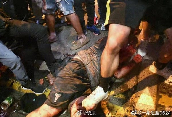 大陆游客在香港被残忍私刑 本人发声：“从地狱爬回的一天”（组图） - 7