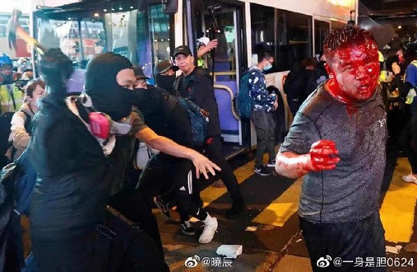大陆游客在香港被残忍私刑 本人发声：“从地狱爬回的一天”（组图） - 5