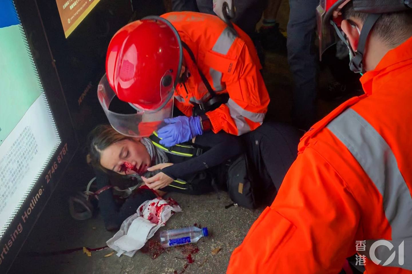8月11日尖沙咀冲突中，一名女子右眼受伤。 （资料图片/ 梁焕敏摄）
