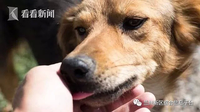 63岁老翁被爱犬舔了一口，全身细菌感染16天后惨死！法医却这样说...（组图） - 4