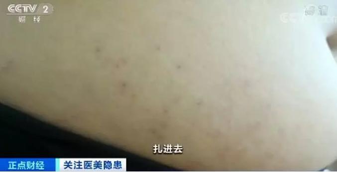 美容乱象再调查：学了3天就敢操刀上阵，宾馆开房做手术 （组图） - 1