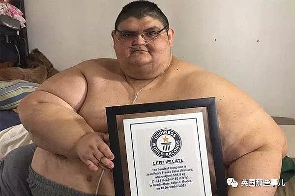 世界最胖男子成功减掉660斤…曾重达半吨多的他，过得太不容易（组图） - 2
