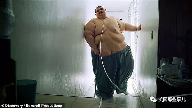 世界最胖男子成功减掉660斤…曾重达半吨多的他，过得太不容易（组图） - 5