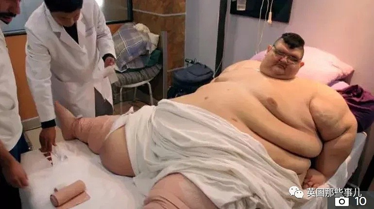 世界最胖男子成功减掉660斤…曾重达半吨多的他，过得太不容易（组图） - 12