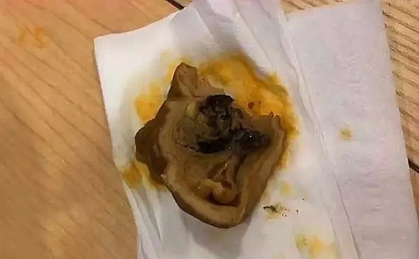 肥肠米线里吃出屎，食客拒十倍赔偿：你来吃我给你钱（视频/图） - 1