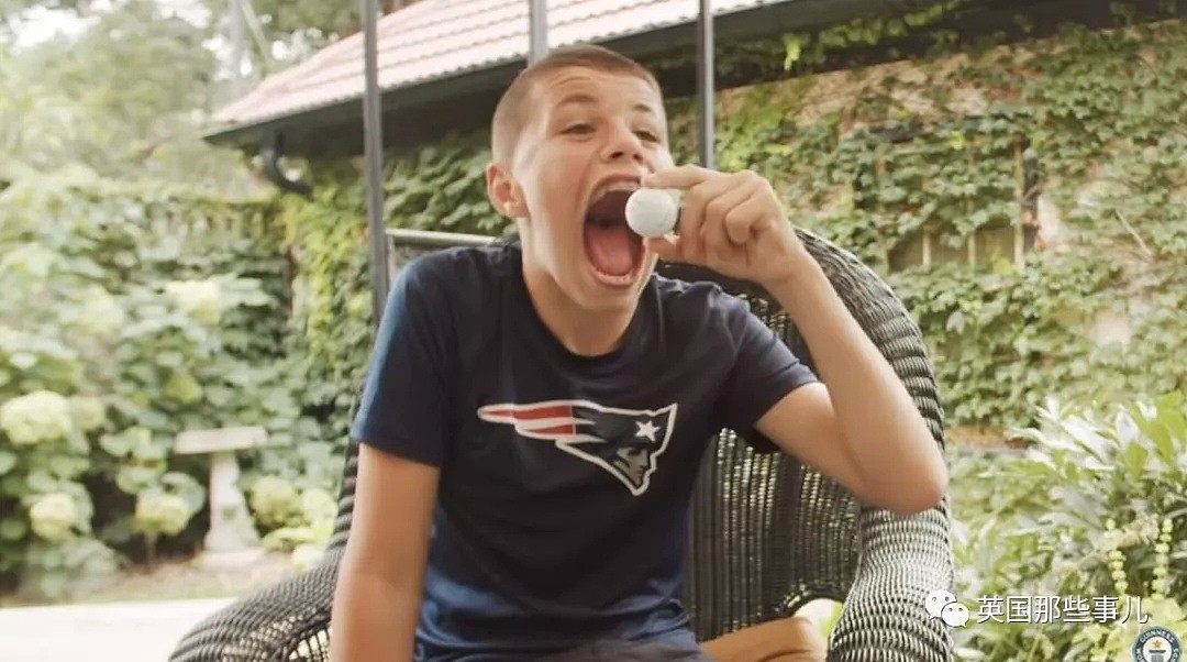 嘴大到破了世界纪录是什么画风，这14岁小男孩嘴里能塞个棒球！（组图） - 8