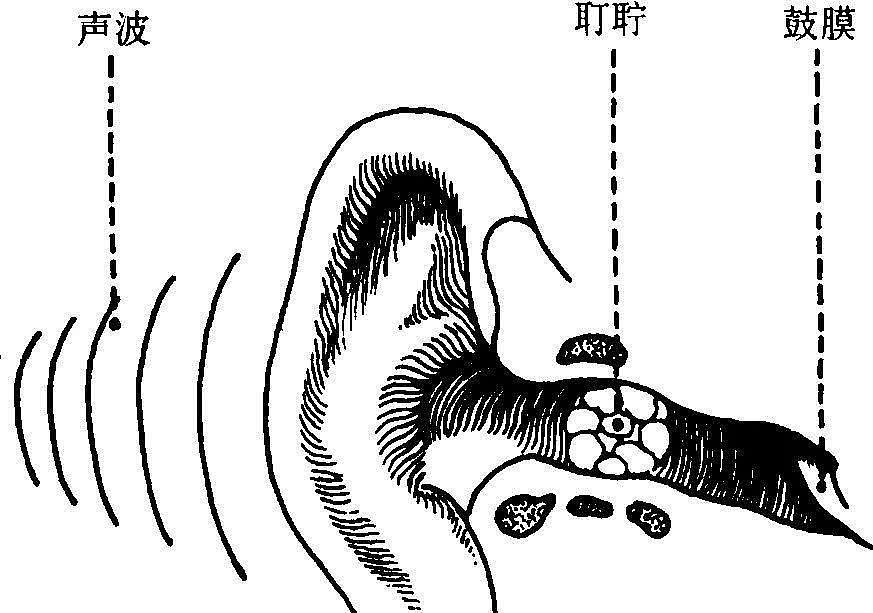 每个喜欢采耳的人，都在默默承担着这些风险……（组图） - 5