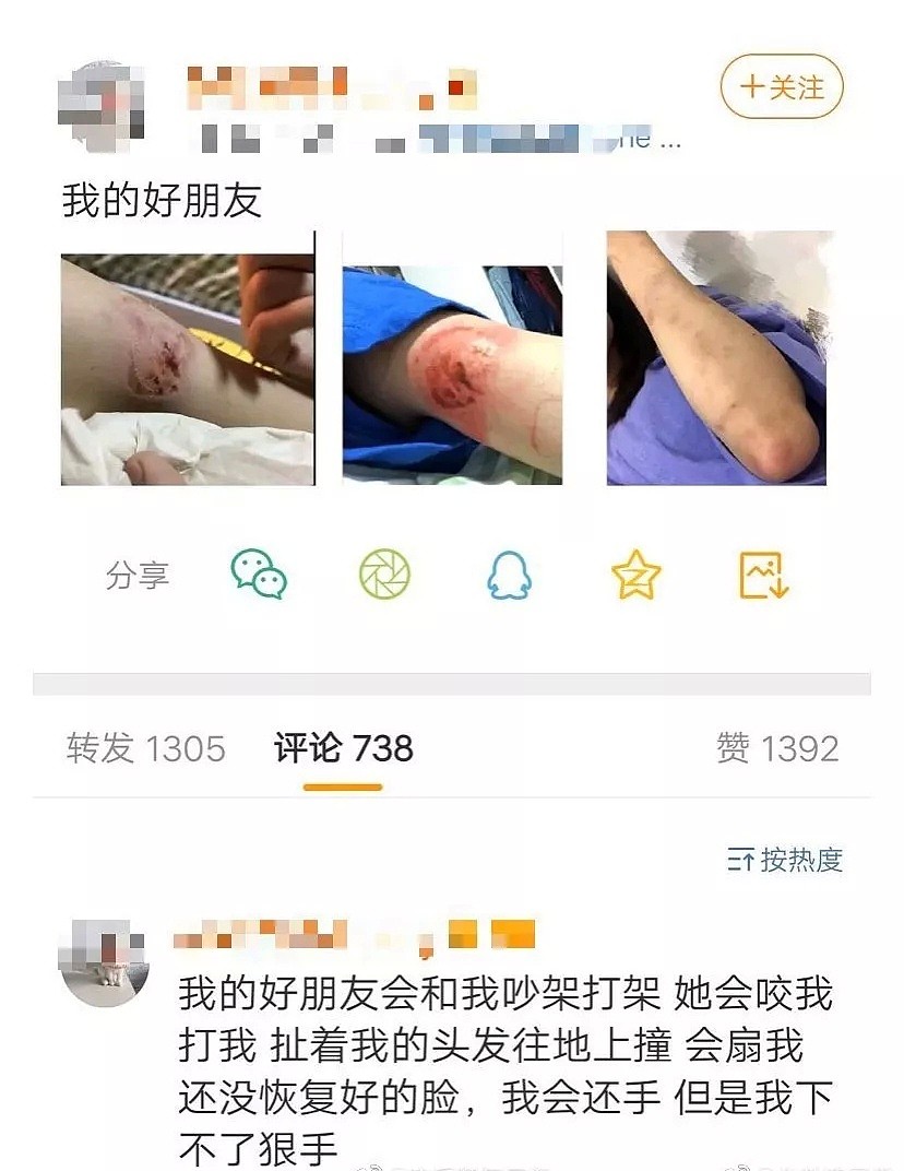 女团成员暴打队友！又咬又打伤口太凶残，和被害人疑似正在恋爱中（组图） - 2