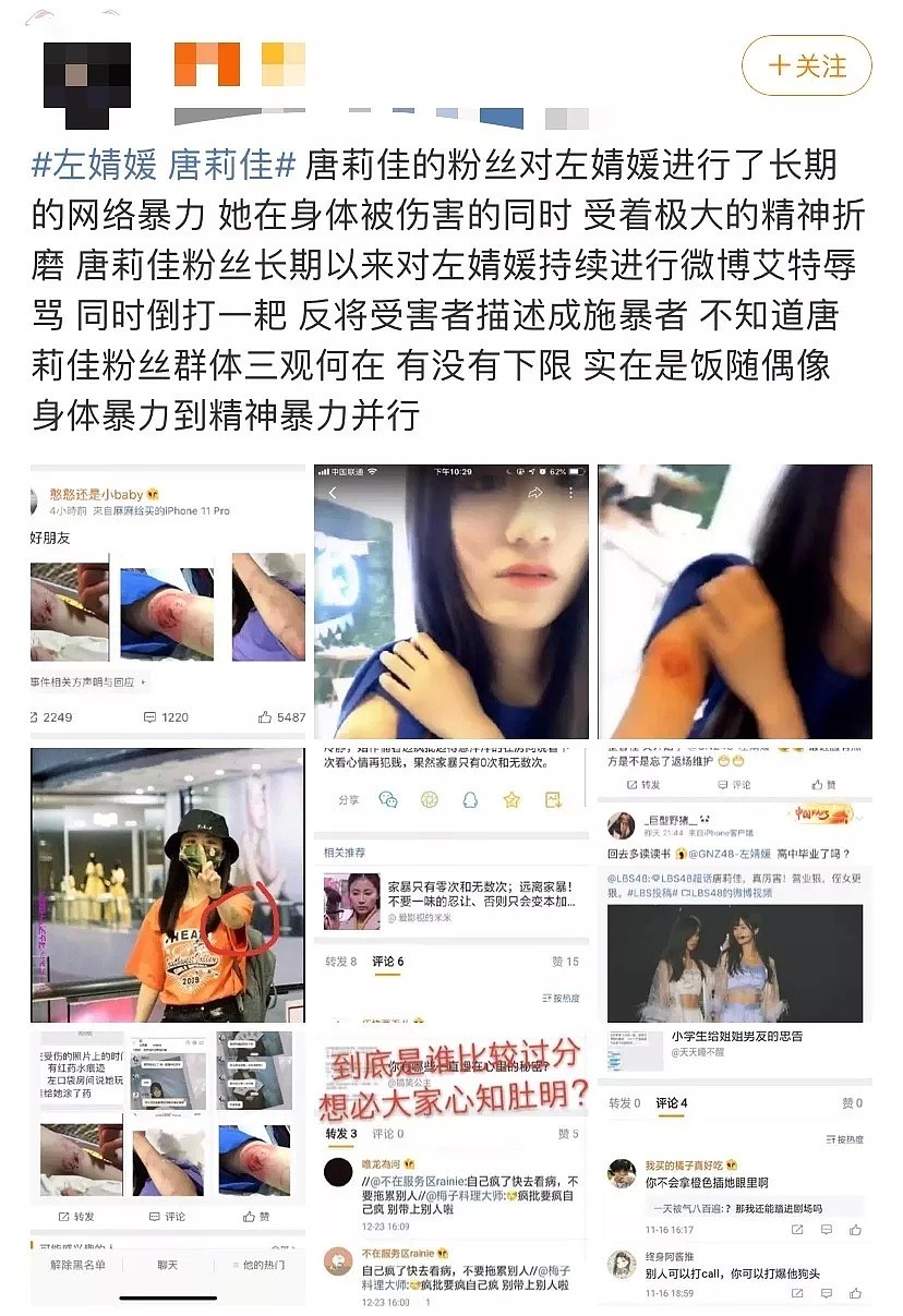 女团成员暴打队友！又咬又打伤口太凶残，和被害人疑似正在恋爱中（组图） - 7