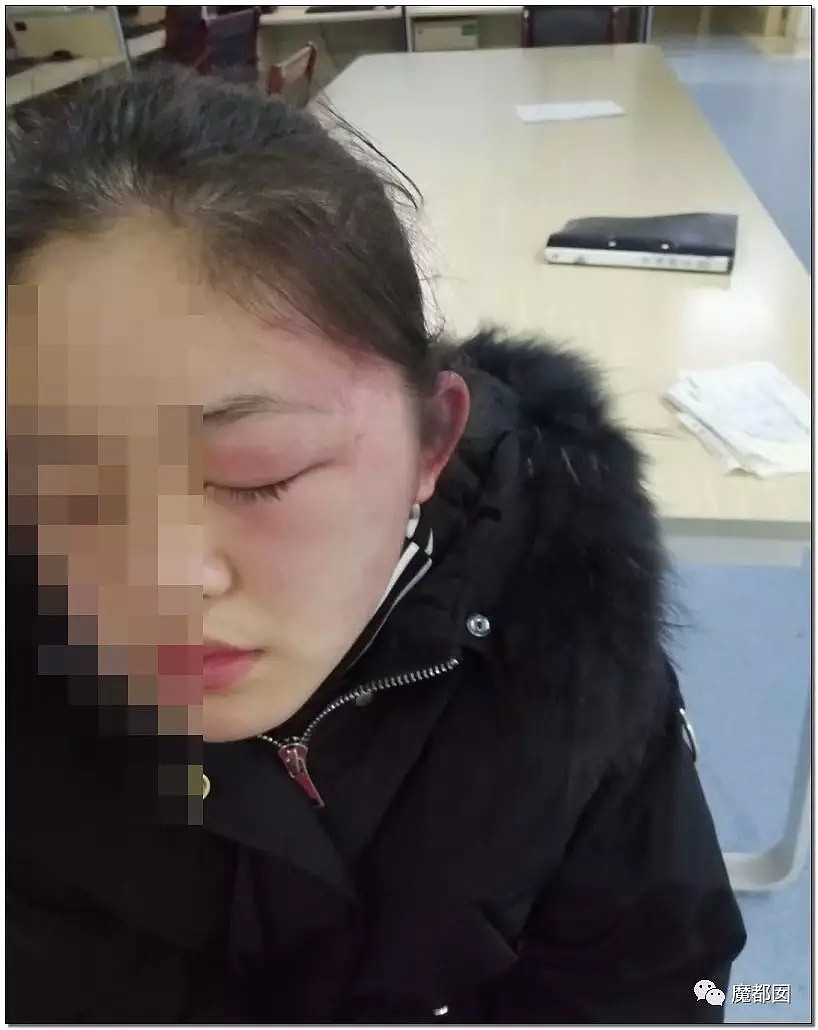 残忍发指！拳打脚踢抽耳光撞墙，中国一初三女生被殴打到内膜出血，现状惨不忍睹！（组图） - 35