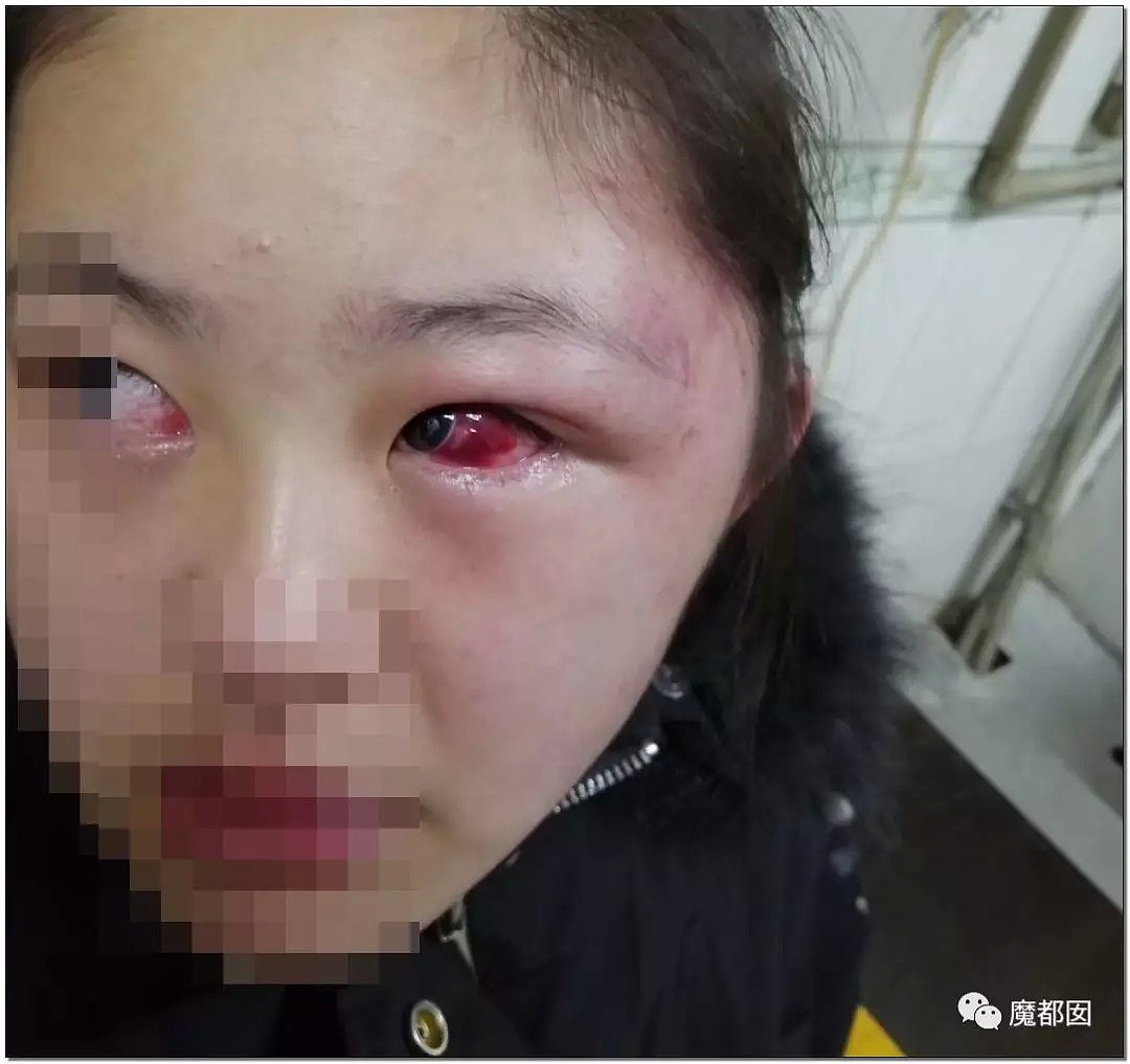 残忍发指！拳打脚踢抽耳光撞墙，中国一初三女生被殴打到内膜出血，现状惨不忍睹！（组图） - 38