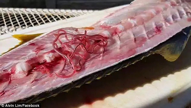 惊爆！澳洲大量虾类体内竟存在寄生虫！爱吃海鲜的华人注意，大批患者因贪吃“体内长虫”！（组图） - 13