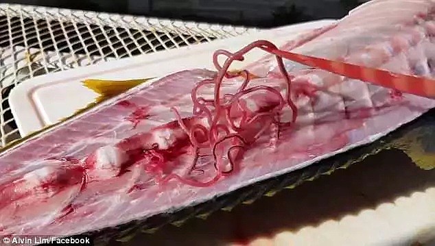 惊爆！澳洲大量虾类体内竟存在寄生虫！爱吃海鲜的华人注意，大批患者因贪吃“体内长虫”！（组图） - 15