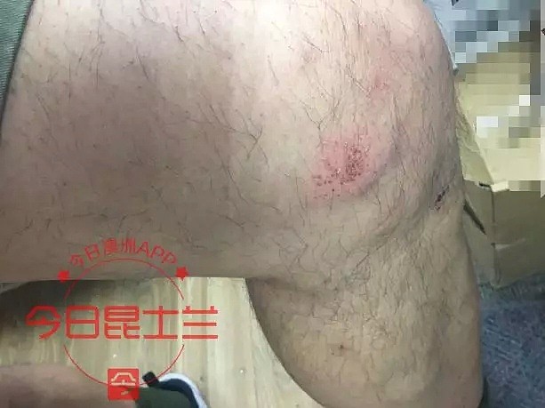 澳华人遭6名teenager群殴，被拳打脚踢受伤 - 7