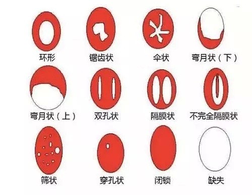 谁能想到处女膜竟然是个“大骗子”呢？（组图） - 12