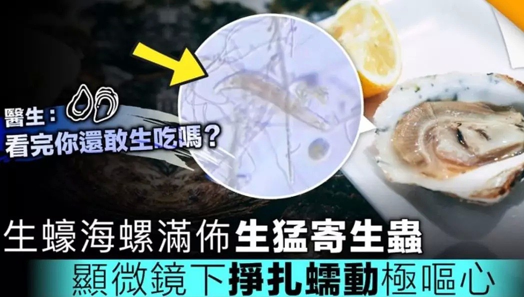 华人男子吃生蚝时没注意这件事儿，结果瘫痪在床，只剩眼球能动！还有人惨遭截肢、甚至丧命...（组图） - 6