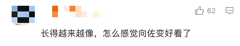 郭碧婷嫁向佐越来越丑？生图脸僵下巴歪苹果肌肿，满脸油腻全是坑 （组图） - 12