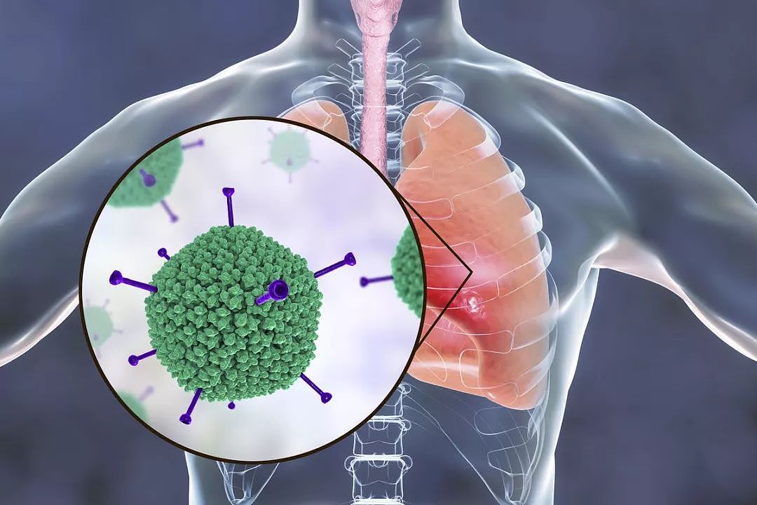 从免疫学的角度，预测这场新型肺炎还会持续多久?（图） - 2