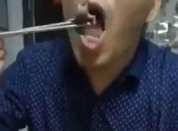 慎点！中国男子吃小老鼠登澳媒头条，这等奇葩“美食”太恶心（视频/组图） - 3