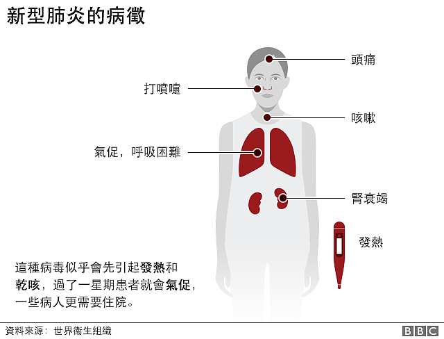 示意图