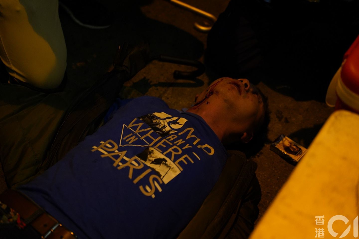 内地男子在香港惨遭“私了”，头破血流惨不忍睹！港媒称因其来自武汉...（组图） - 4