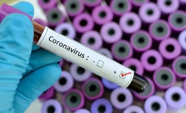 厉害了！新西兰科学家成功培育出冠状病毒将加速疫苗研制！（组图） - 5