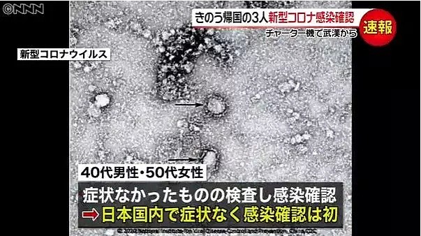 日本新冠肺炎已增至13例！求求各位了，给日本人也留点口罩吧！（组图） - 4