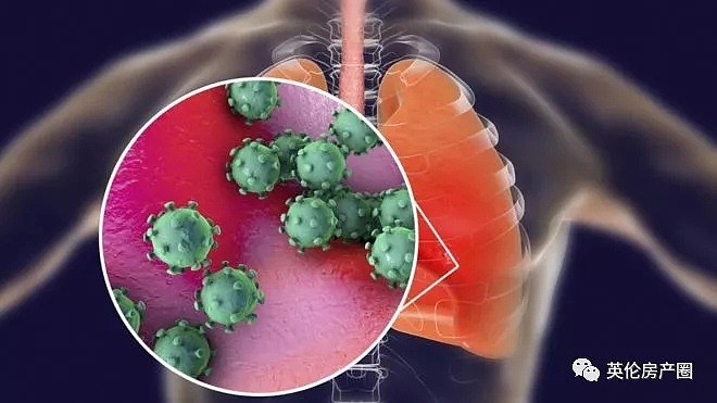 突发！英国确诊两例新冠病毒病例，正在接受救治！（组图） - 5