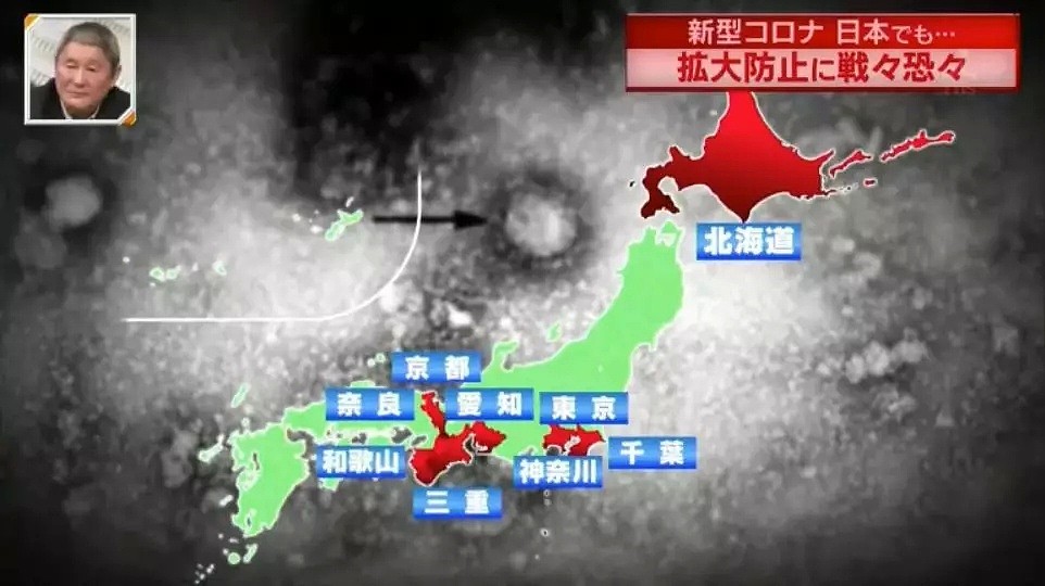 第20例！日本已经成为海外第一灾区！本地医院的口罩告急！（组图） - 3