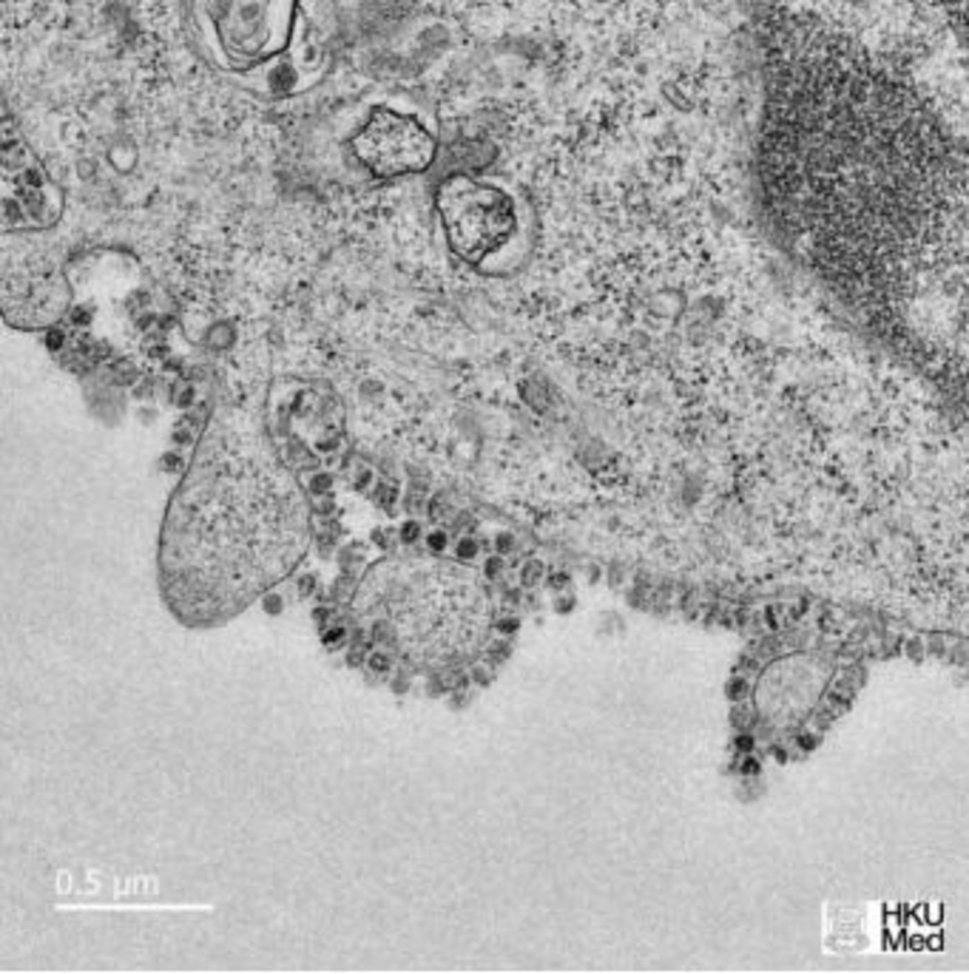 新型冠状病毒长这样：显微镜下繁衍数量惊人        