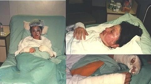 香港武打女星有多拼？爆炸戏眉毛被烧脸换皮，她60岁还被火烧伤（组图） - 10