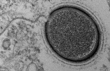 全球最狠的神秘病毒！3万年前诞生，至今仍能传染人类！（组图） - 9