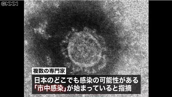 确诊飙升至414人！日本政府承认“情况有变，病毒已在日本扩散”，还说：勤洗手就好，不用戴口罩？！（组图） - 17